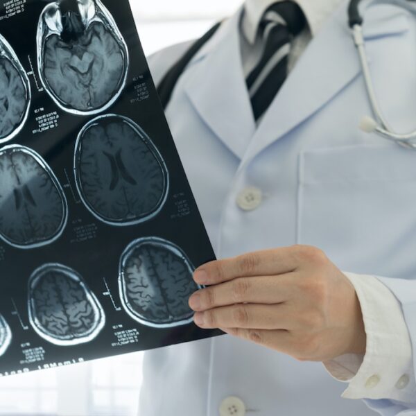 brain-tumor-symptoms